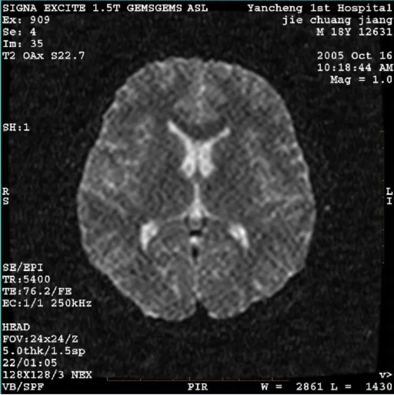 ARTIFACT WI/Fiesta Hình ảnh Pixel trắng